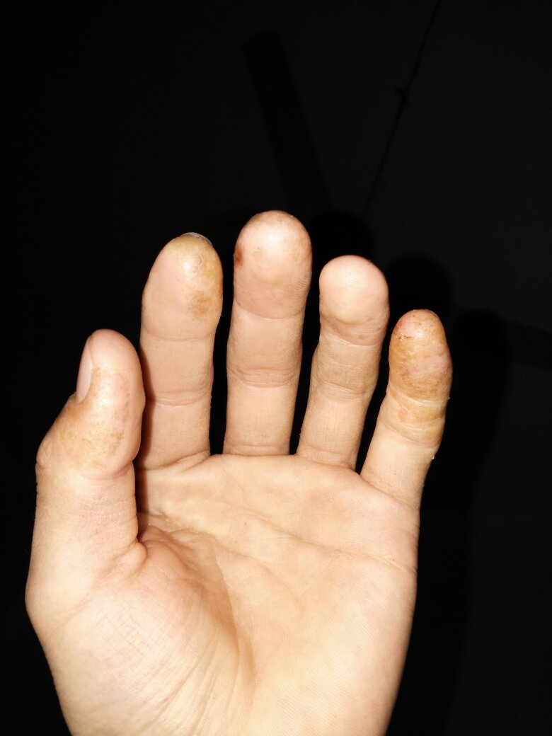 梦境侦探无线耳机在哪里 梦境侦探无线耳机位置详解|beat365官网中文(图3) 梦境侦探无线耳机在哪里 梦境侦探无线耳机位置详解|beat365官网中文(图3)